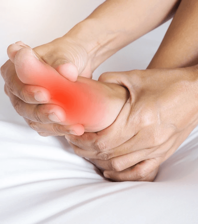 Bunion progression stages
