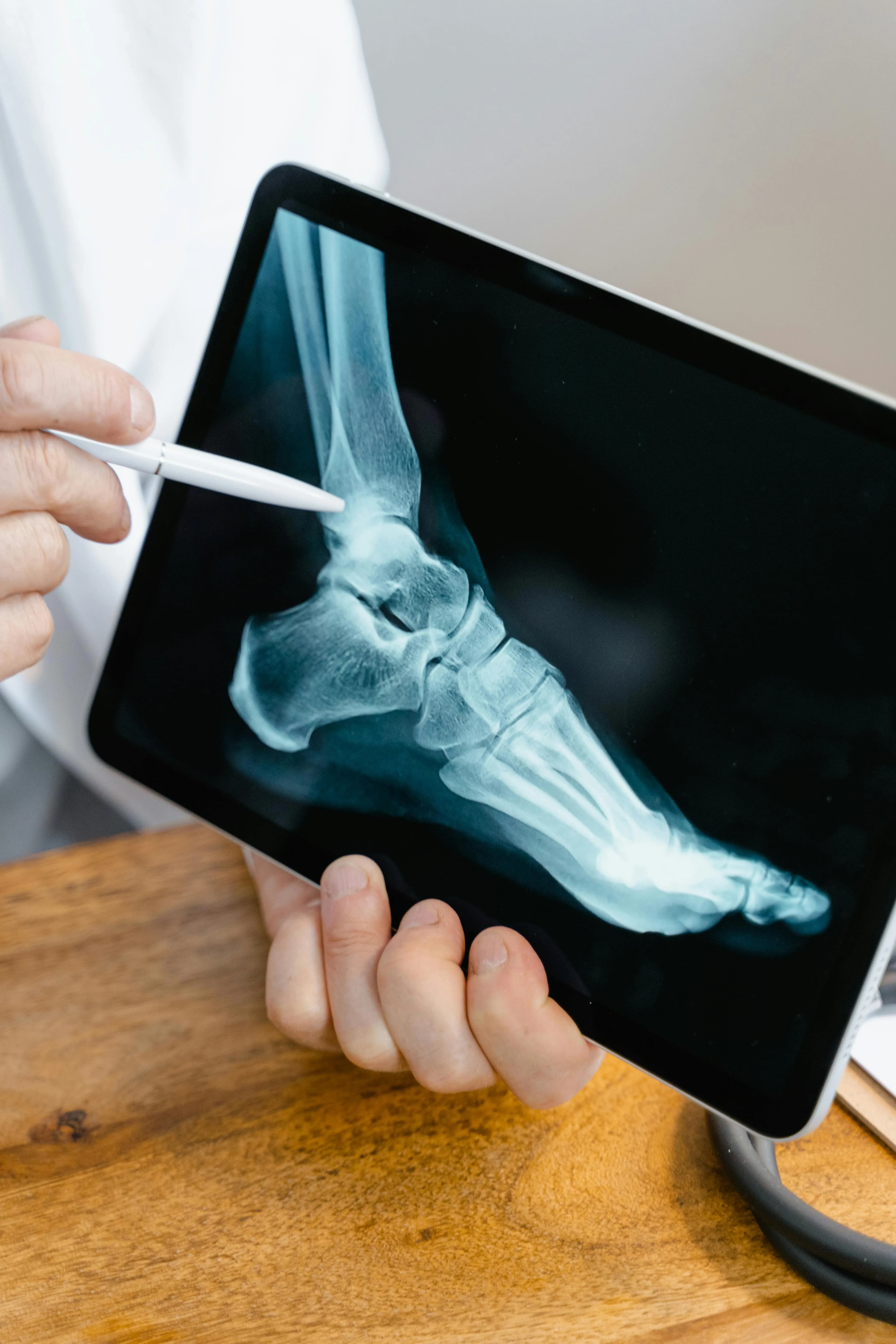 Doctor pointing to a foot and ankle X-ray on a tablet