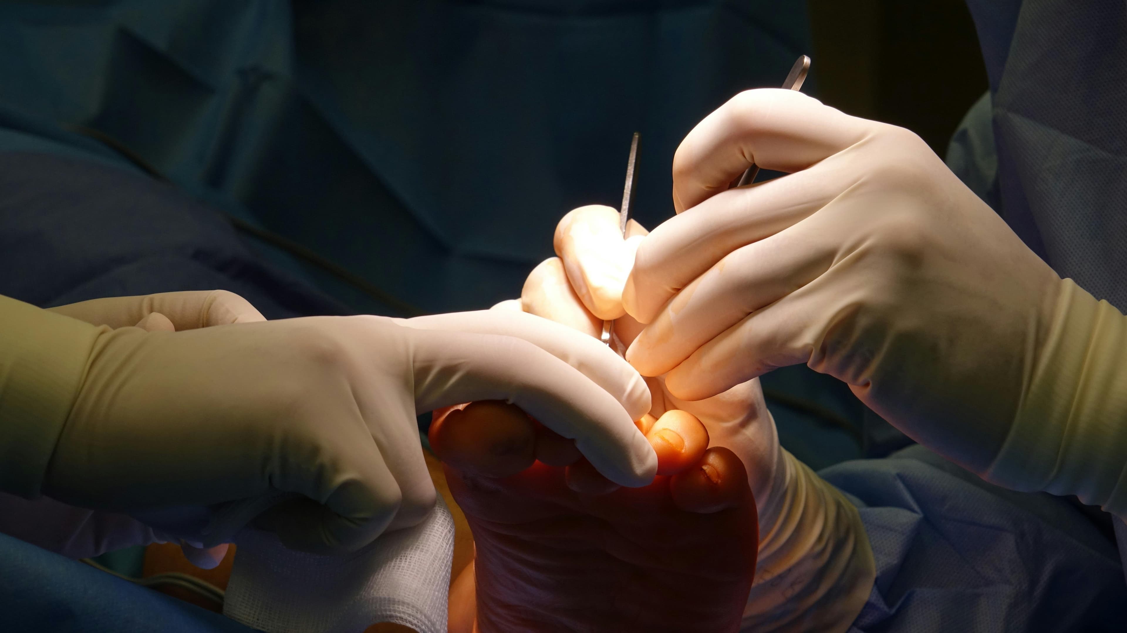 Podiatric surgeon performing foot surgery in a sterile operating room